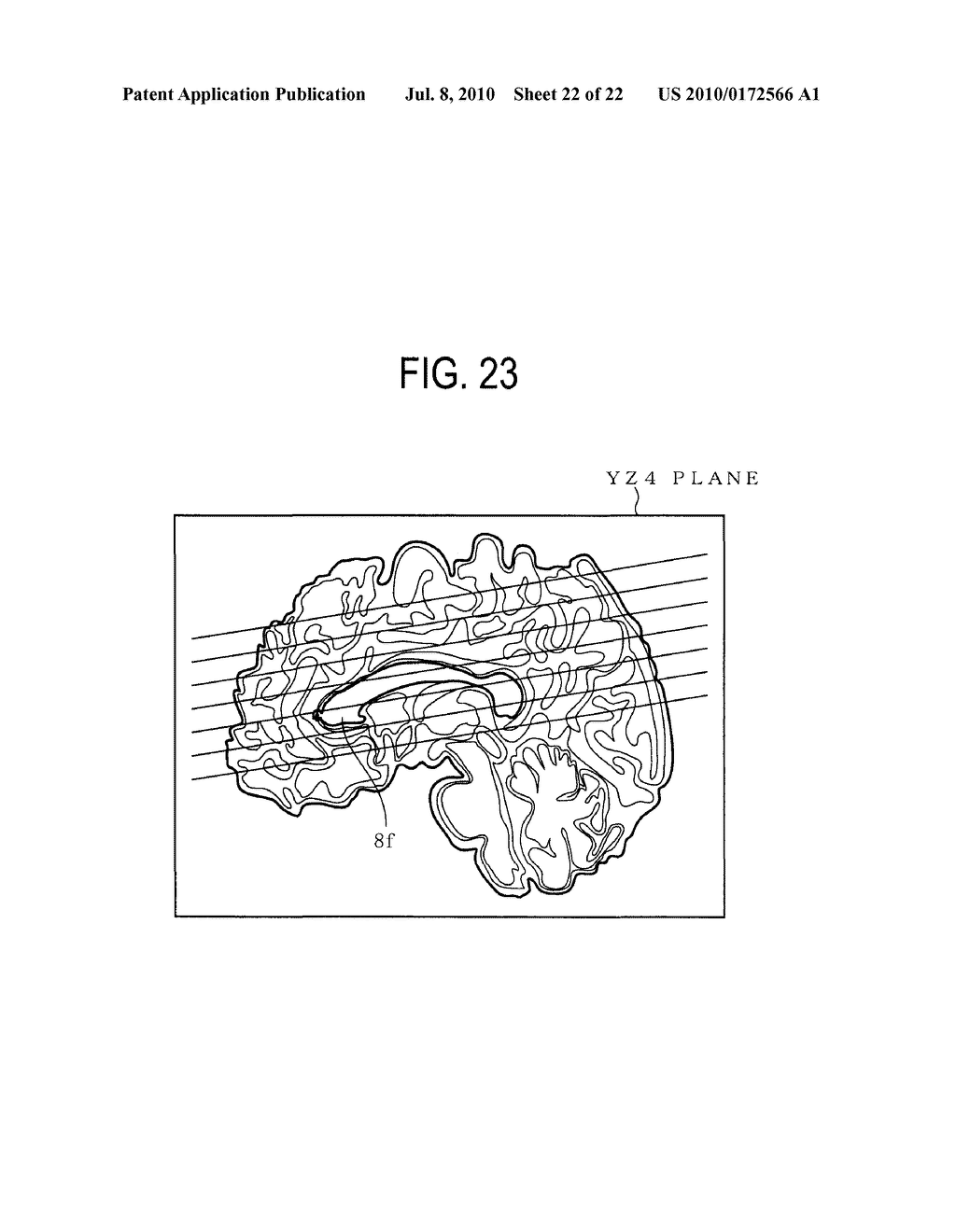 MEDIAN PLANE DETERMINATION APPARATUS AND MAGNETIC RESONANCE IMAGING SYSTEM - diagram, schematic, and image 23