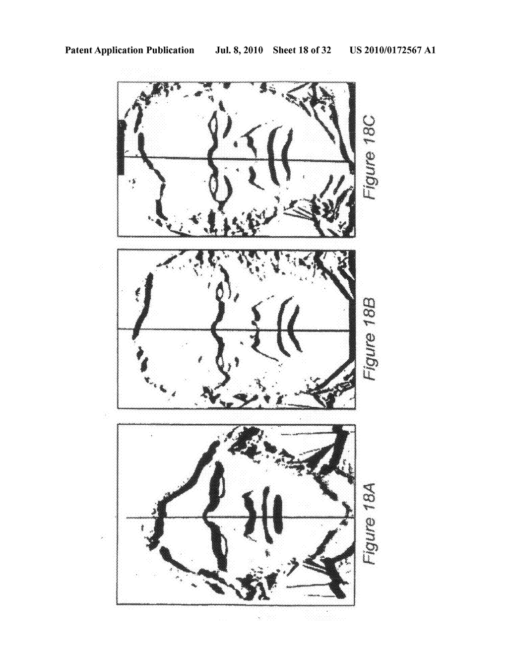 SYSTEM AND METHOD FOR USING THREE DIMENSIONAL INFRARED IMAGING TO PROVIDE DETAILED ANATOMICAL STRUCTURE MAPS - diagram, schematic, and image 19
