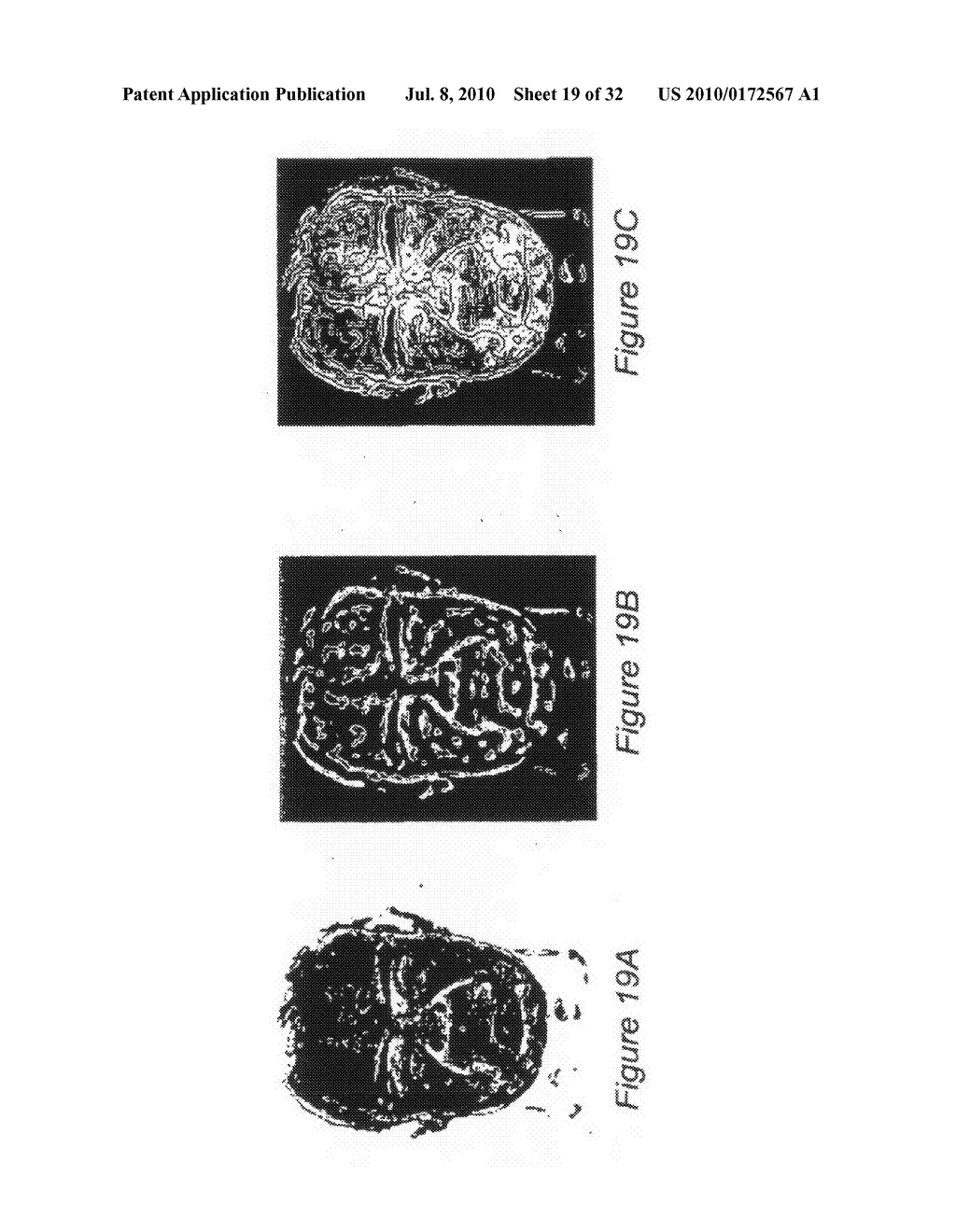 SYSTEM AND METHOD FOR USING THREE DIMENSIONAL INFRARED IMAGING TO PROVIDE DETAILED ANATOMICAL STRUCTURE MAPS - diagram, schematic, and image 20