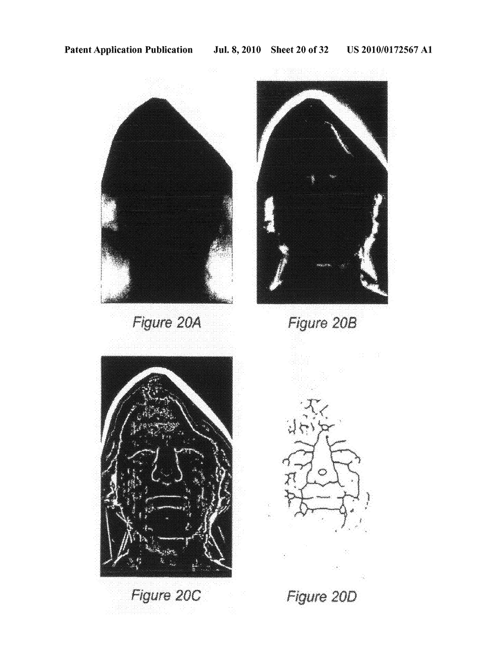 SYSTEM AND METHOD FOR USING THREE DIMENSIONAL INFRARED IMAGING TO PROVIDE DETAILED ANATOMICAL STRUCTURE MAPS - diagram, schematic, and image 21