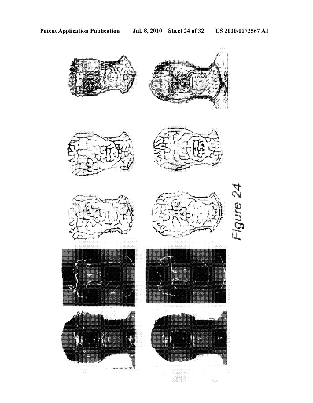 SYSTEM AND METHOD FOR USING THREE DIMENSIONAL INFRARED IMAGING TO PROVIDE DETAILED ANATOMICAL STRUCTURE MAPS - diagram, schematic, and image 25