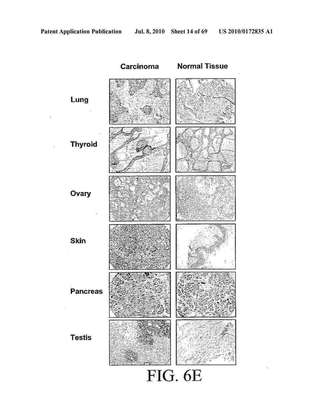 METHODS AND COMPOSITIONS FOR SYNAPHICALLY-TARGETED TREATMENT FOR CANCER - diagram, schematic, and image 15