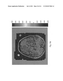 ASSESSMENT OF BLOOD-BRAIN BARRIER DISRUPTION diagram and image