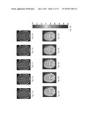 ASSESSMENT OF BLOOD-BRAIN BARRIER DISRUPTION diagram and image