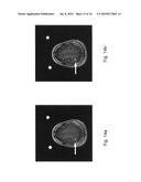 ASSESSMENT OF BLOOD-BRAIN BARRIER DISRUPTION diagram and image