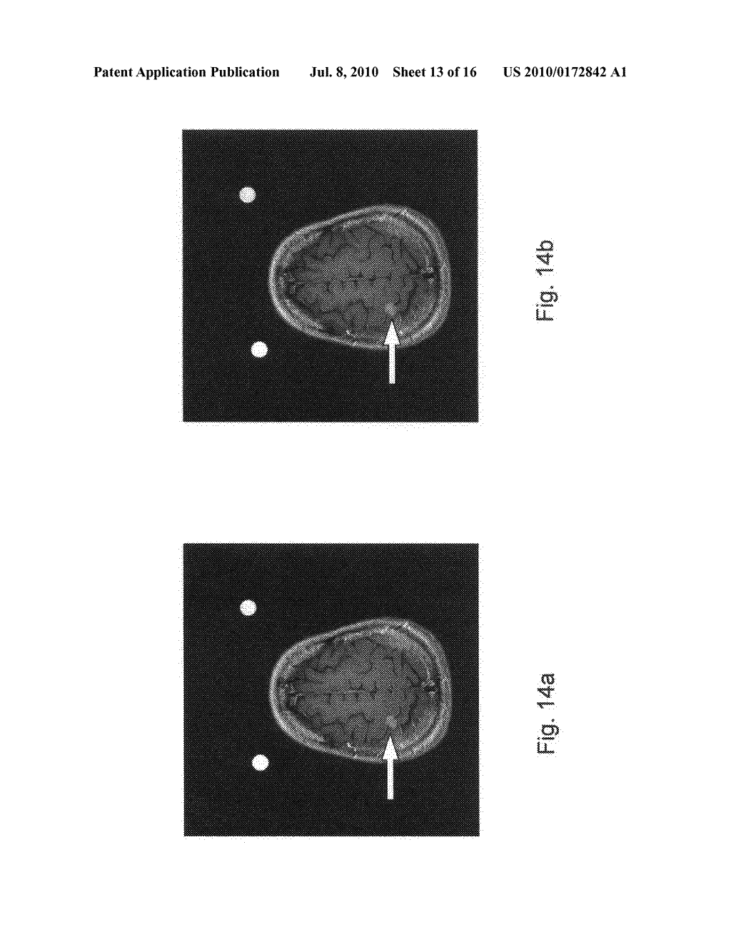 ASSESSMENT OF BLOOD-BRAIN BARRIER DISRUPTION - diagram, schematic, and image 14