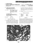 Cardiac Muscle Repair Or Regeneration Using Bone Marrow-Derived Stem Cells diagram and image