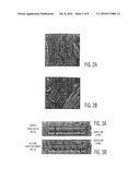 Cardiac Muscle Repair Or Regeneration Using Bone Marrow-Derived Stem Cells diagram and image