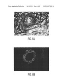 Cardiac Muscle Repair Or Regeneration Using Bone Marrow-Derived Stem Cells diagram and image