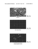 Cardiac Muscle Repair Or Regeneration Using Bone Marrow-Derived Stem Cells diagram and image