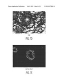 Cardiac Muscle Repair Or Regeneration Using Bone Marrow-Derived Stem Cells diagram and image