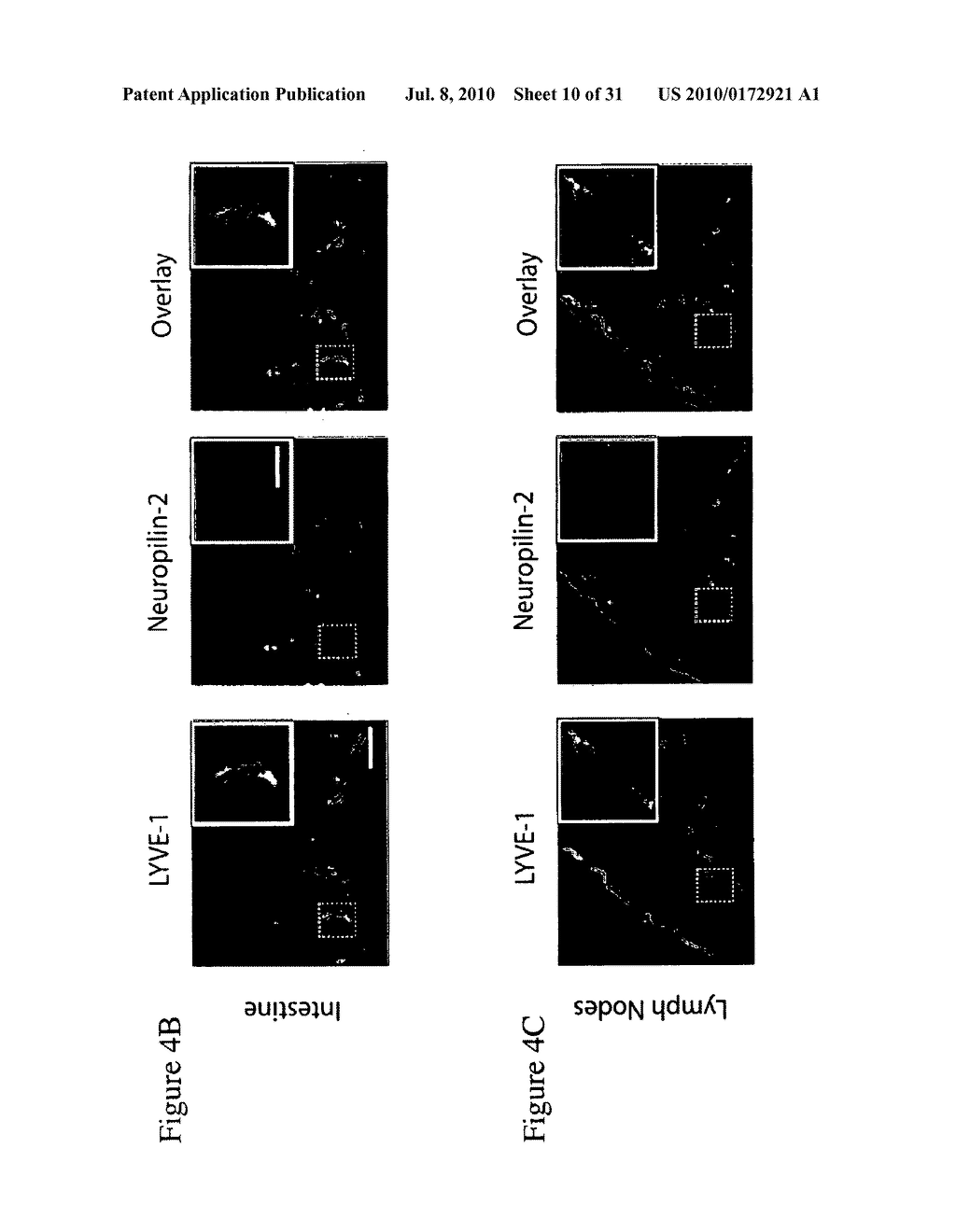 INHIBITION OF TUMOR METASTASIS BY ANTI NEUROPILIN 2 ANTIBODIES - diagram, schematic, and image 11