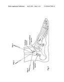 TREATMENT OF SOFT TISSUE INJURY USING HYALURONIC ACID AND BOTULINUM TOXIN diagram and image