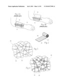 Wound dressing devices and methods diagram and image