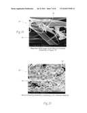 Wound dressing devices and methods diagram and image