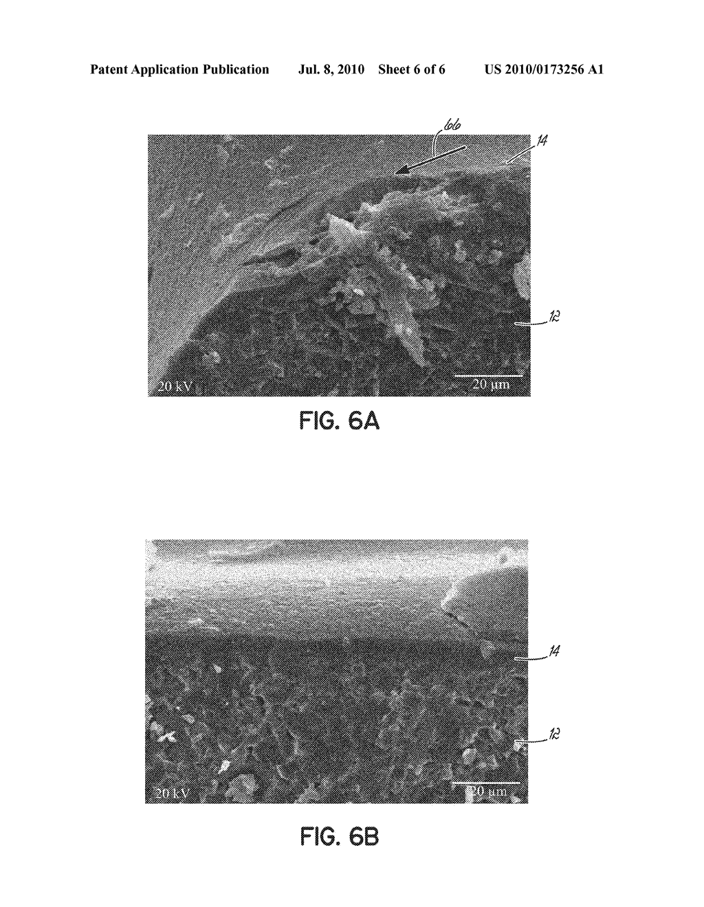 Surface Treated Polycrystalline Ceramic Orthodontic Bracket and Method of Making Same - diagram, schematic, and image 07
