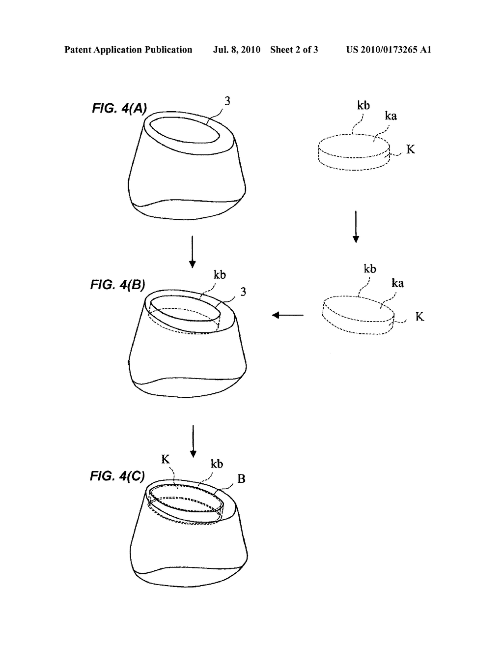 METHOD FOR CREATING THREE-DIMENSIONAL DATA OF POSITION OF OUTER PERIPHERY AT OCCLUSAL SURFACE SIDE OF KEEPER WITH RESPECT TO ABUTMENT FOR IMPLANT - diagram, schematic, and image 03