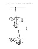 Exercise Pole Device diagram and image