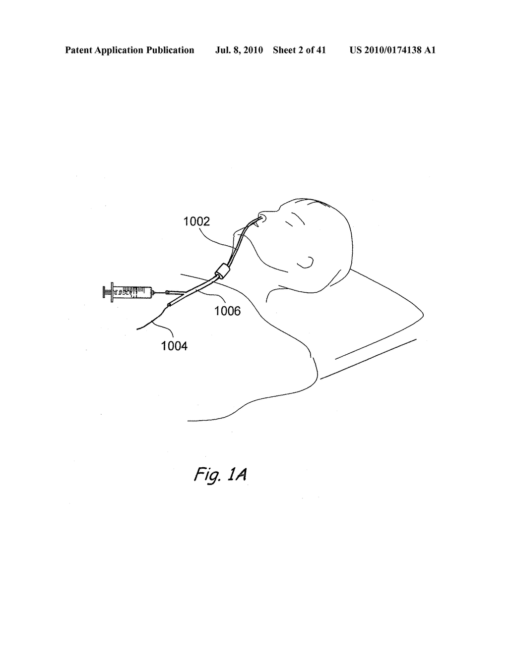 DEVICES, SYSTEMS AND METHODS USEABLE FOR TREATING SINUSITIS - diagram, schematic, and image 03