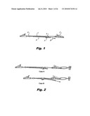 Internal Retraction Systems and Devices diagram and image