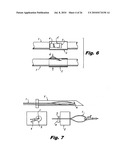 Internal Retraction Systems and Devices diagram and image