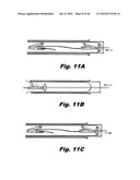 Internal Retraction Systems and Devices diagram and image