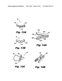 Internal Retraction Systems and Devices diagram and image