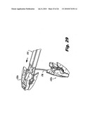 Internal Retraction Systems and Devices diagram and image