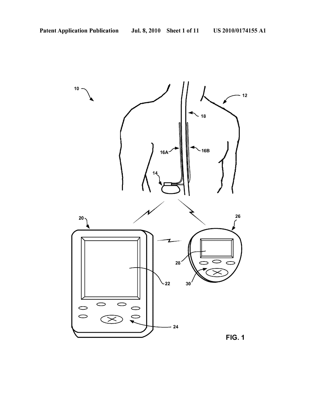 COLLECTING SLEEP QUALITY INFORMATION VIA A MEDICAL DEVICE - diagram, schematic, and image 02