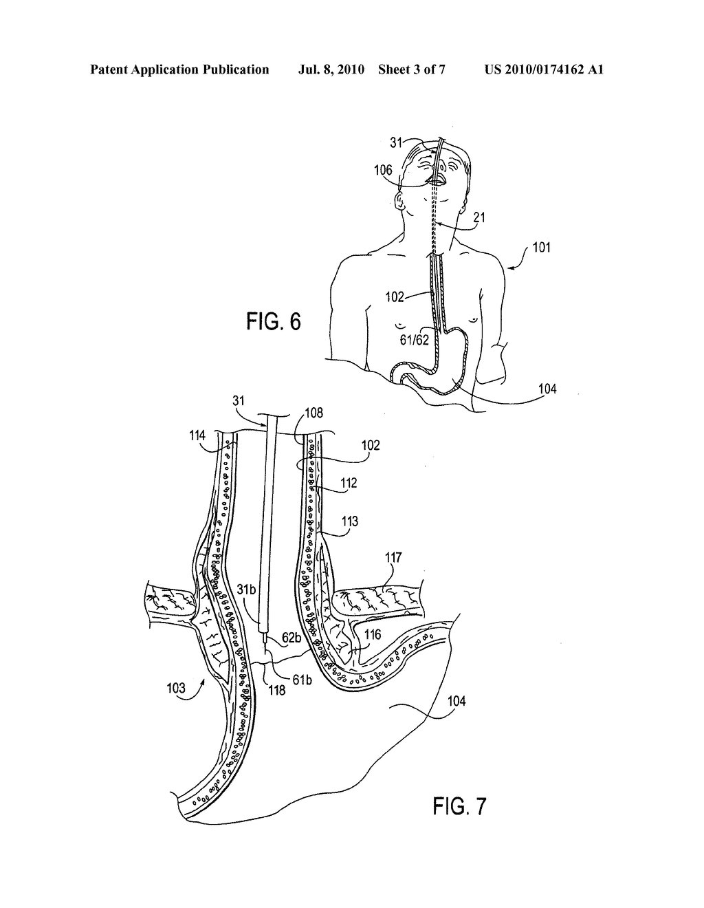 INJECTION DEVICE - diagram, schematic, and image 04