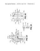 ANCHORED IMPLANTABLE PRESSURE MONITOR diagram and image