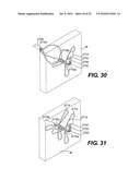 ANCHORED IMPLANTABLE PRESSURE MONITOR diagram and image