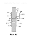 ANCHORED IMPLANTABLE PRESSURE MONITOR diagram and image