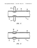 Apparatus for Delivery of Therapeutic Material to an Intervertebral Disc and Method of Use diagram and image