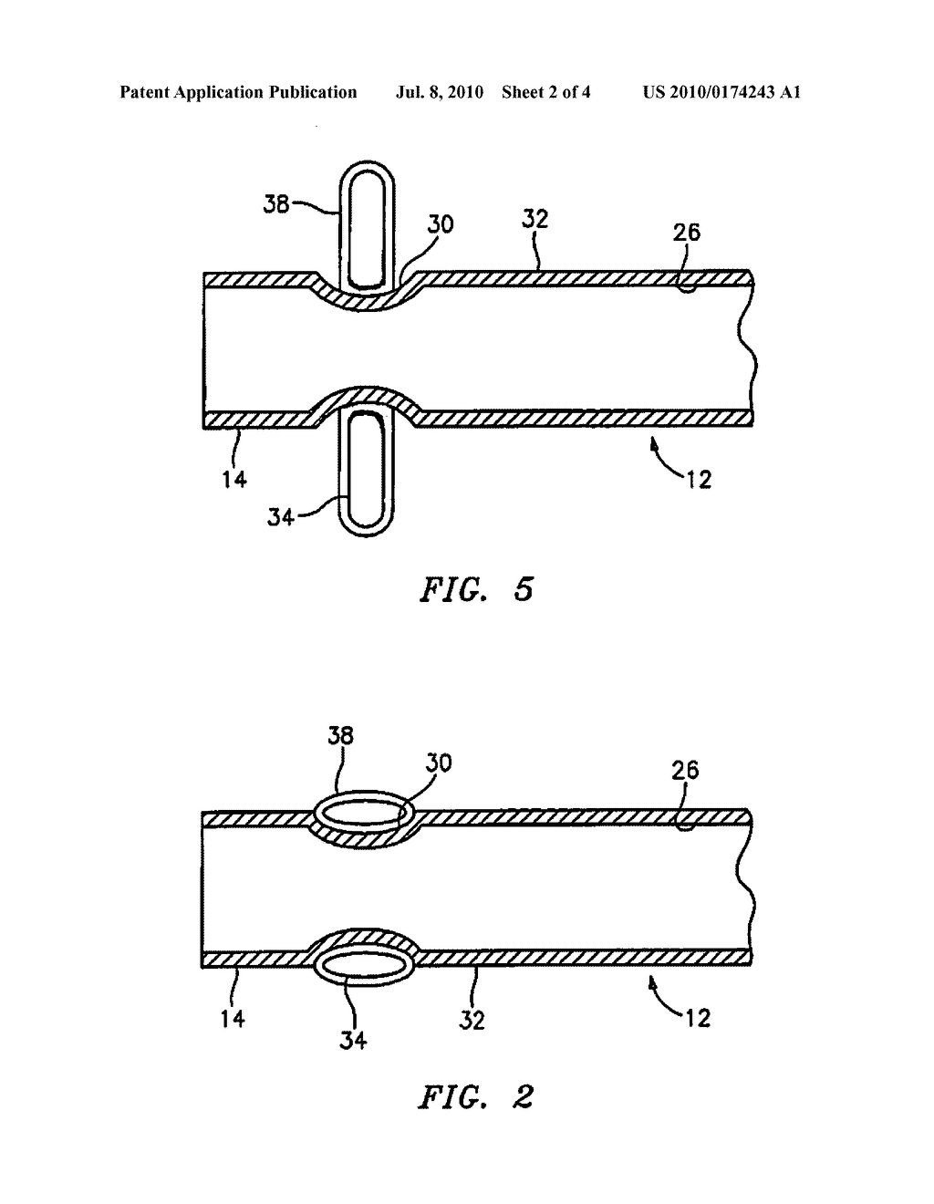 Apparatus for Delivery of Therapeutic Material to an Intervertebral Disc and Method of Use - diagram, schematic, and image 03