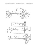 HOLLOW CURVED SUPERELASTIC MEDICAL NEEDLE AND METHOD diagram and image