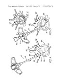 HOLLOW CURVED SUPERELASTIC MEDICAL NEEDLE AND METHOD diagram and image