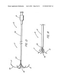 HOLLOW CURVED SUPERELASTIC MEDICAL NEEDLE AND METHOD diagram and image