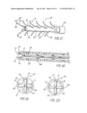 HOLLOW CURVED SUPERELASTIC MEDICAL NEEDLE AND METHOD diagram and image