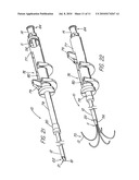 HOLLOW CURVED SUPERELASTIC MEDICAL NEEDLE AND METHOD diagram and image