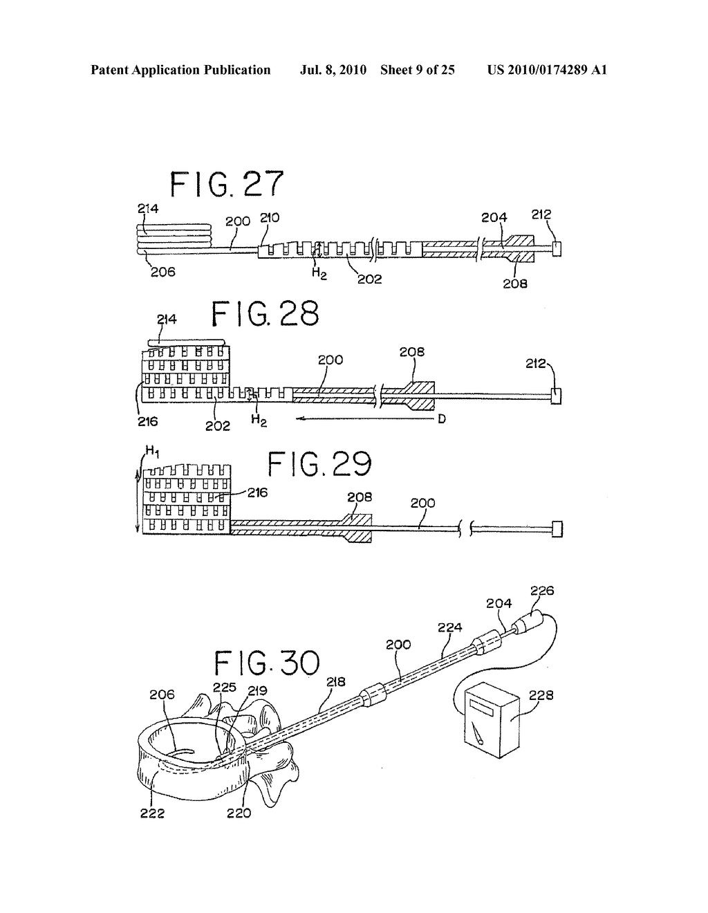 Devices for Limiting the Movement of Material Introduced Between Layers of Spinal Tissue - diagram, schematic, and image 10