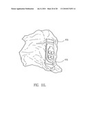 STERILE SURGICAL ADAPTOR diagram and image