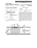 INTRAVASCULAR STENT FOR TREATING VULNERABLE PLAQUE AND METHOD OF USE diagram and image