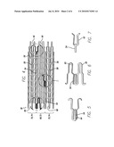 INTRAVASCULAR STENT FOR TREATING VULNERABLE PLAQUE AND METHOD OF USE diagram and image