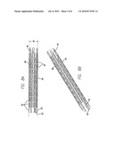 INTRAVASCULAR STENT FOR TREATING VULNERABLE PLAQUE AND METHOD OF USE diagram and image