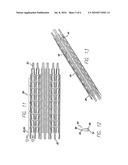 INTRAVASCULAR STENT FOR TREATING VULNERABLE PLAQUE AND METHOD OF USE diagram and image