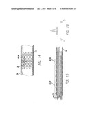 INTRAVASCULAR STENT FOR TREATING VULNERABLE PLAQUE AND METHOD OF USE diagram and image