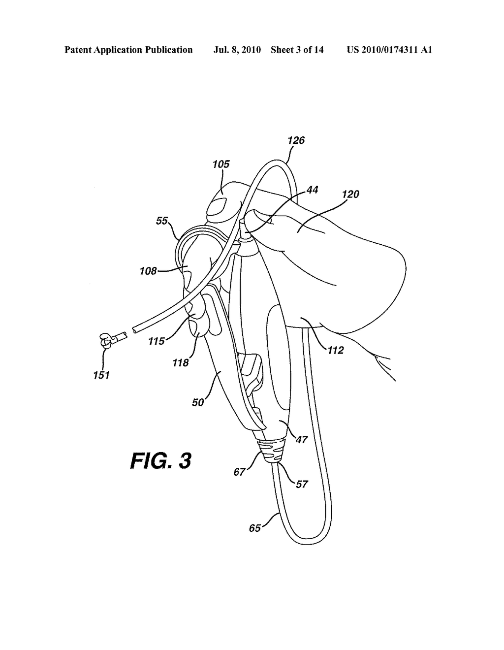 Actuation Apparatus and Method - diagram, schematic, and image 04