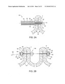 COMPRESSIBLE TISSUE ANCHOR ASSEMBLIES diagram and image