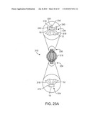 COMPRESSIBLE TISSUE ANCHOR ASSEMBLIES diagram and image